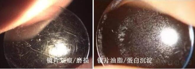 更换新的梦戴维镜片需要停戴吗？有哪些流程？