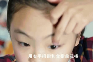 角膜塑形镜老是取不下来的5种原因分析
